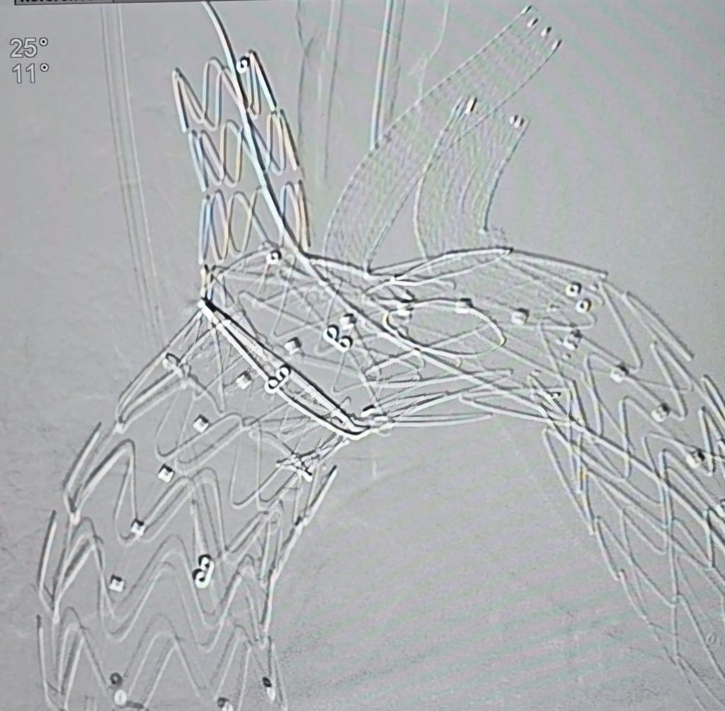 1737015363457